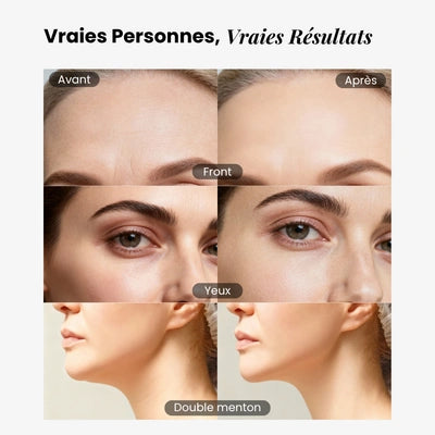 Brosse Drainage Lymphatique