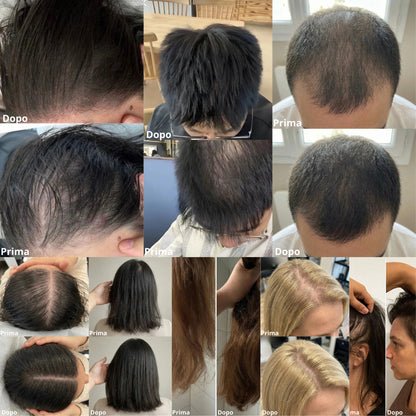 Trattamento Solido Artigianale: Anti-Caduta, Crescita e Anti-Forfora | 100% Naturale