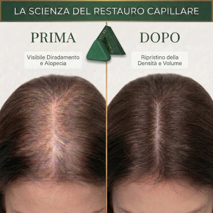 Trattamento Solido Artigianale: Anti-Caduta, Crescita e Anti-Forfora | 100% Naturale